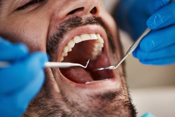 Best Emergency Treatment for Toothache in Sea Girt, NJ